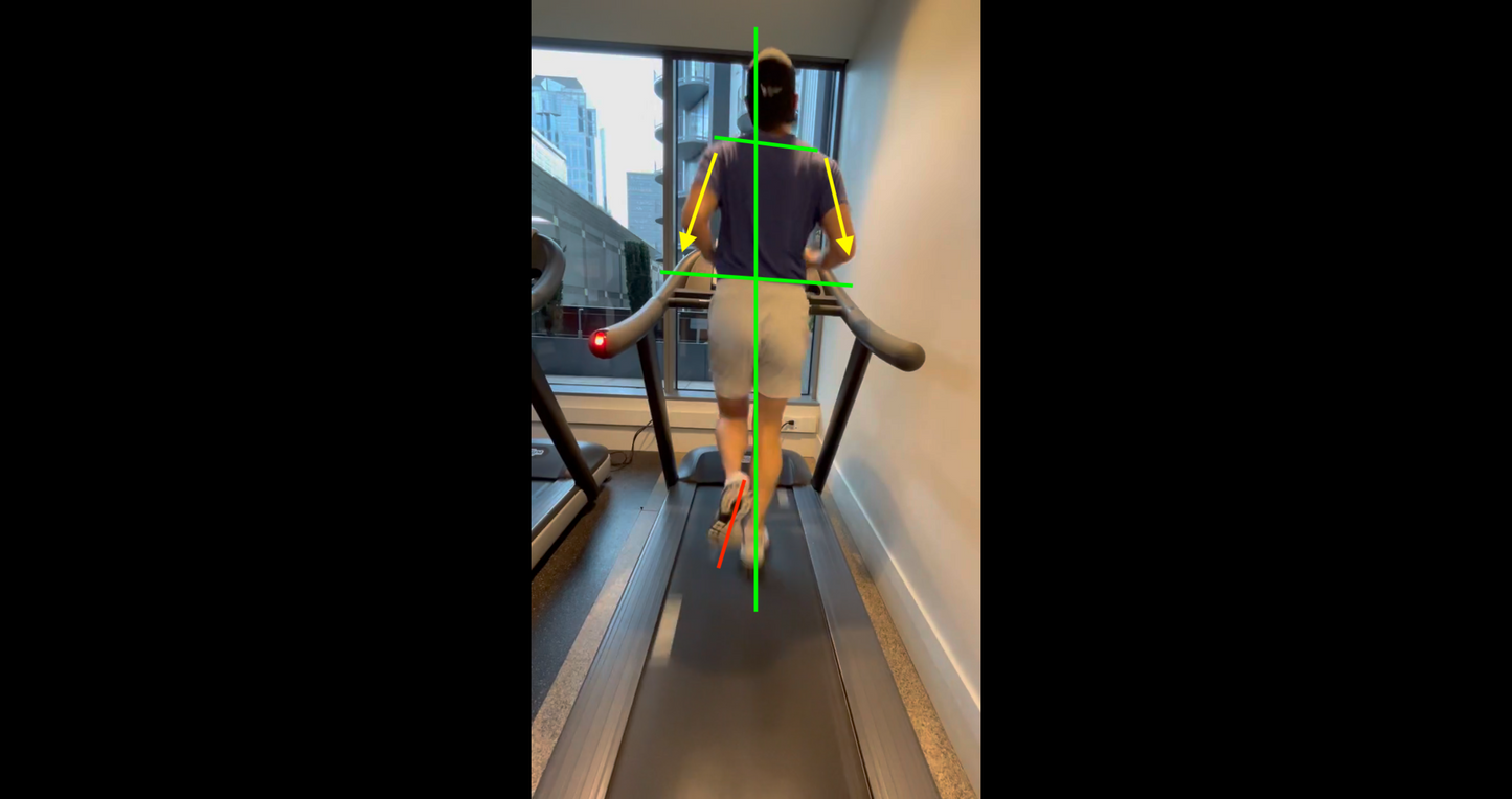 Gait Analysis Video & ShoeSense Device
