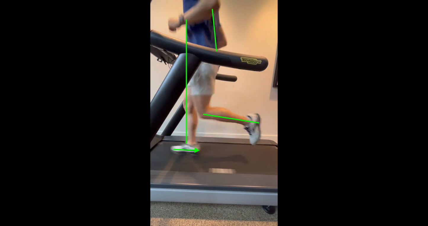 Gait Analysis Video & Consult